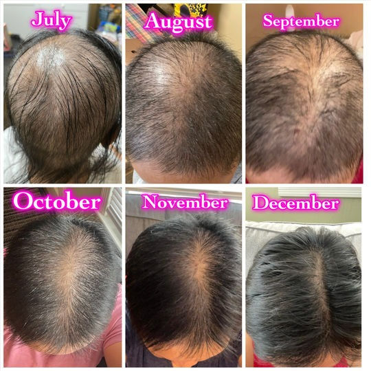 FEG HAIR GROWTH SPRAY